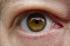 auf besonderen wunsch ein Auge ;-)