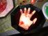 full_amputiertehand.jpg