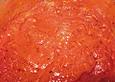 Pizzasauce