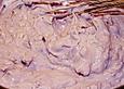 Heidelbeer - Vanille - Quark