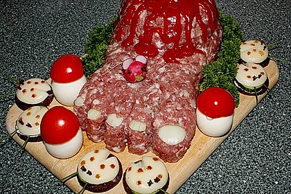 Amputierter Fuß 1