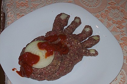 Amputierter Fuß 20
