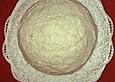 Raffaelo - Torte