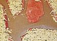 Schnitzel mit R&ouml;stikruste